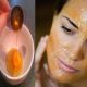 Egg yolk applied to improve Skin health