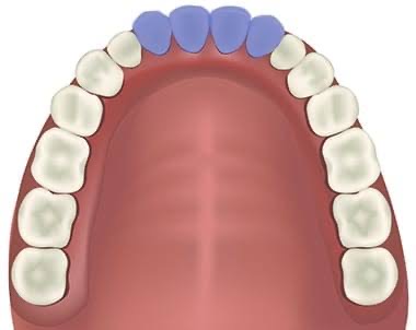 Different teeth names