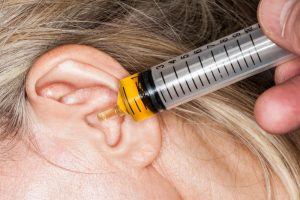 A GUIDE FOR EAR IRRIGATION