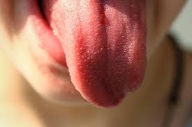 TREATMENT OF GROWTH UNDER THE TONGUE