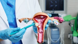 PREVENTION OF UTERINE FIBROIDS