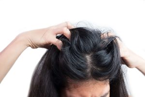 PREVENTION OF SCALP YEAST INFECTION