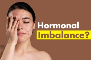 TREATMENT OF HORMONAL IMBALANCES