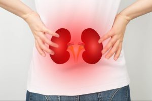 PREVENTION OF KIDNEY PROBLEM