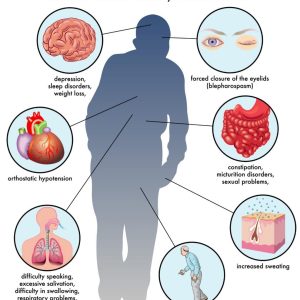 CAUSES OF PARKINSON’S DISEASE