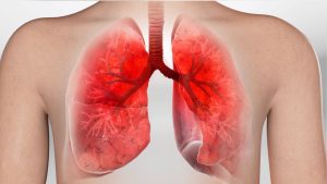 SYMPTOMS OF BRONCHITIS