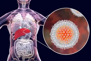 TREATMENT OF HEPATITIS C