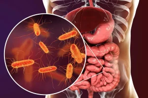 SYMPTOMS OF E.COLI
