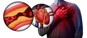 CAUSES OF HEART BLOCKS