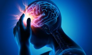 CONCUSSIONS