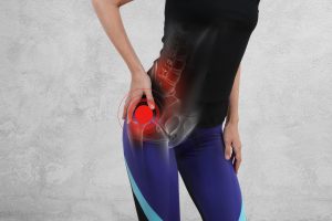 TROCHANTERIC BURSITIS