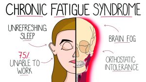 CHRONIC FATIGUE SYNDROME