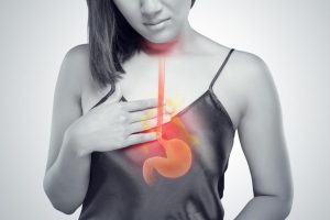 CAUSES OF ACID REFLUX
