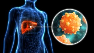 SIGNS OF HEPATITIS B