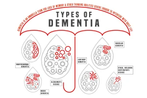 VASCULAR DEMENTIA