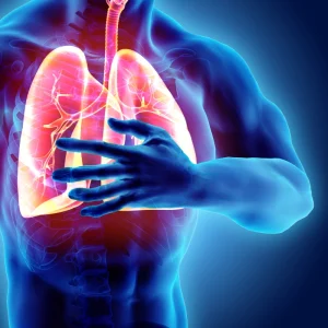 PULMONARY FIBROSIS