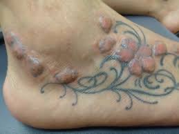 Tattoos