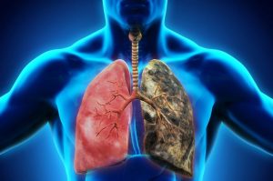 RESPIRATORY DISEASE