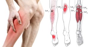 CAUSES OF RESTLESS  LEGS SYNDROME