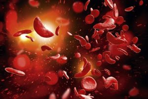 TYPES OF SICKLE CELL DISEASE