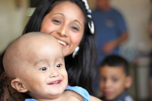 TYPES OF HYDROCEPHALUS