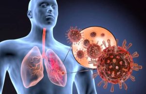 HEALTH IMPACTS OF DUST