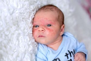 CHILDREN ABDOMINAL PAINS