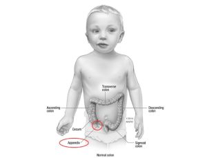 CHILDREN ABDOMINAL PAINS