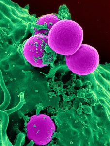 STAPHYLOCOCCUS TRANSMISSION EFFECTS