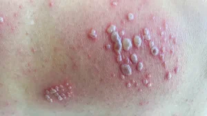 SIGNS AND DEWORMING MEDICATIONS