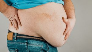 KIDNEY STONES AND IT'S CAUSES