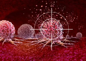 SOLUTIONS FOR BREAST CANCER