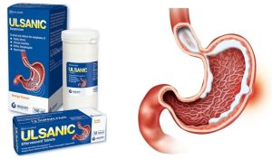 ULCER SIGNS