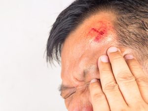 SENSE OF SMELL AND TASTE REDUCTION