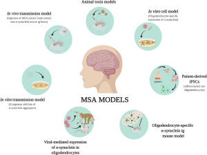 Multiple System Atrophy