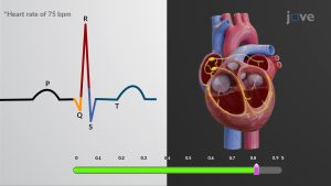 Electrocardiogram and Heart