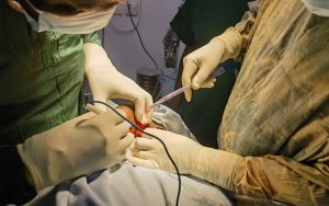 Neurological conditions