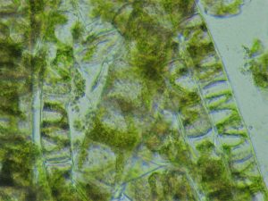 SPIROGYRA 
