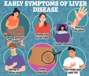 EARLY SIGNS OF LIVER DISEASE