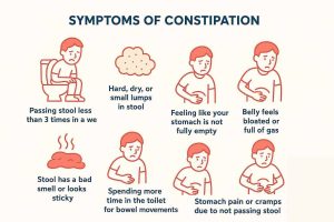 CONSTIPATION REVIEW