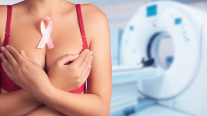 Breast lumps causes