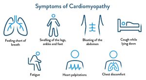 cardiomyopathy analysis