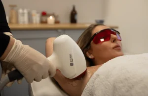 tips for laser hair removal