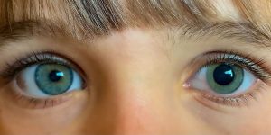 Significance of pupil dilation