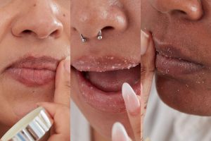 Lips breakage remedies