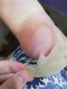 Advantages of foot exfoliating masks