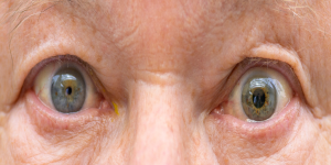 Significance of pupil dilation