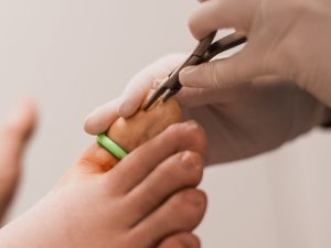 NAILS INJURIES EFFECTS
