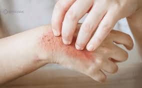 Chest dryness causes