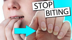 How to stop finger biting